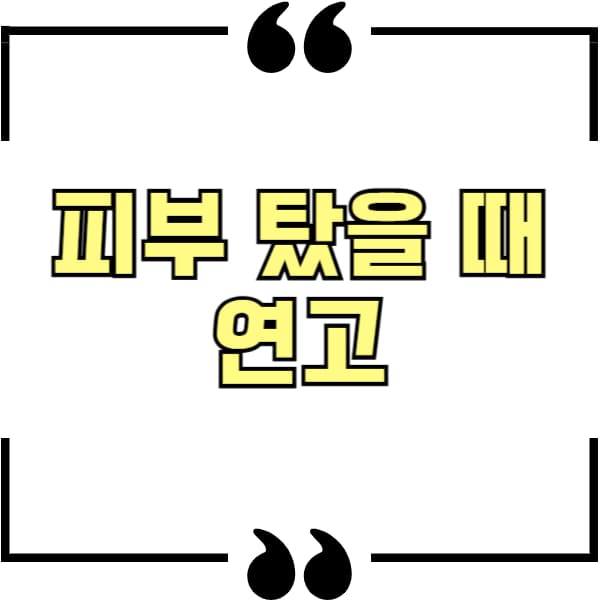 피부 탔을 때 연고